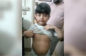 हरियाणा: 7 साल की बच्ची पर कुत्ते का जानलेवा हमला, बाल-बाल बरी