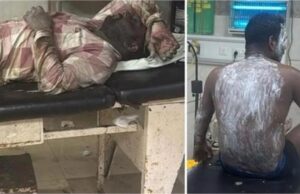 अंबाला फैक्ट्री हादसा: कपड़ा मिल में काम करते चार मजदूर झुलसे, हालत गंभीर होने पर PGI रेफर