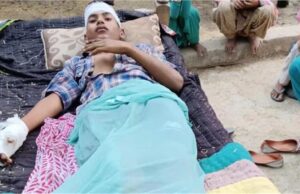 8वीं के छात्र को 11 हजार वोल्ट लाइन से करंट लगा, हैडमास्टर ने तार जोड़ने के लिए चढ़ाया था सीढ़ी पर