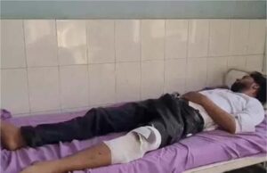 गुरुग्राम में शॉर्प शूटरों का एनकाउंटर, दोनों अपराधी घायल; पंजाब से जुड़े हैं मामले के सुराग